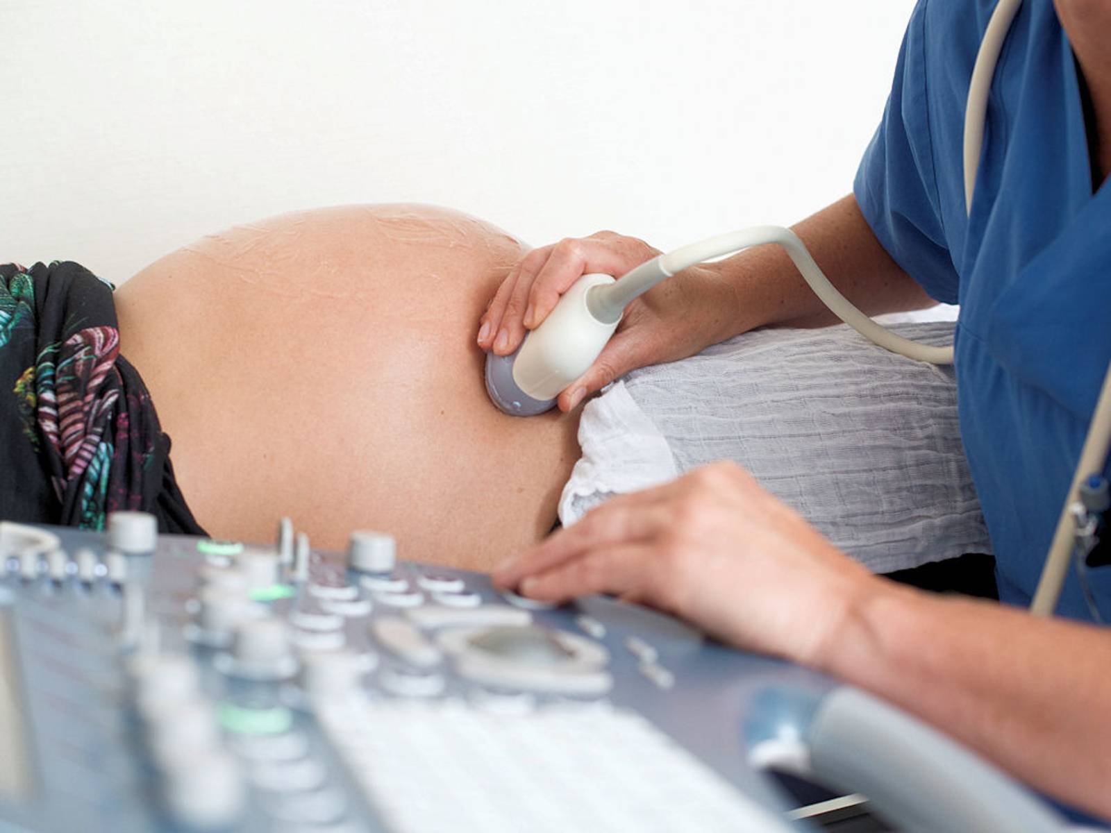 Medizinische Untersuchung an einer Schwangeren
