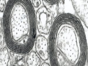 Myelinscheiden im Querschnitt unter dem Elektronenmikroskop.