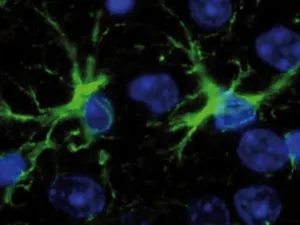 Astrozyten in Gewebe, die mittels einer Immunfluoreszenz-F&auml;rbung (gr&uuml;n) sichtbar gemacht wurden.
