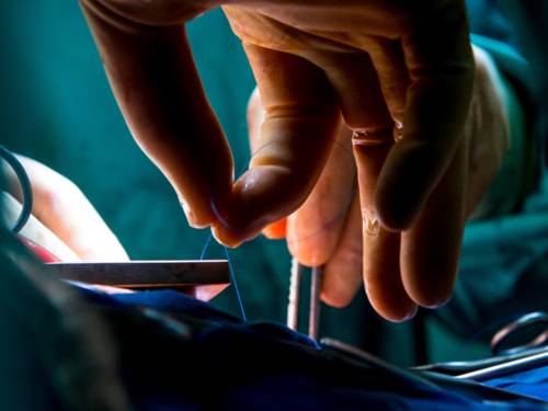 Zwei Hände halten während einer OP einen Operationsfaden