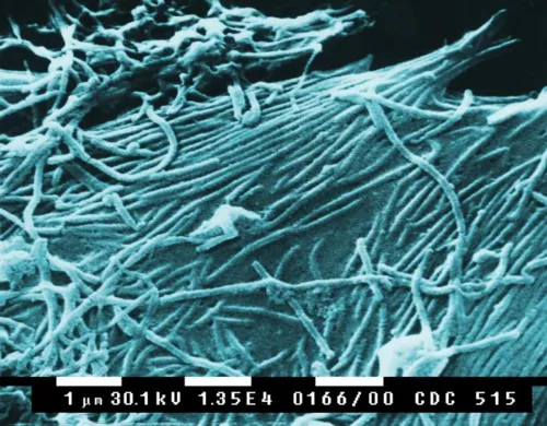 Ebola-Virus