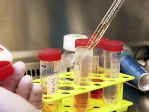 Pipettiervorgang