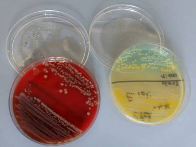 Das Bild zeigt fünf unterschiedliche Nährböden für die Anzucht von Bakterienkulturen.