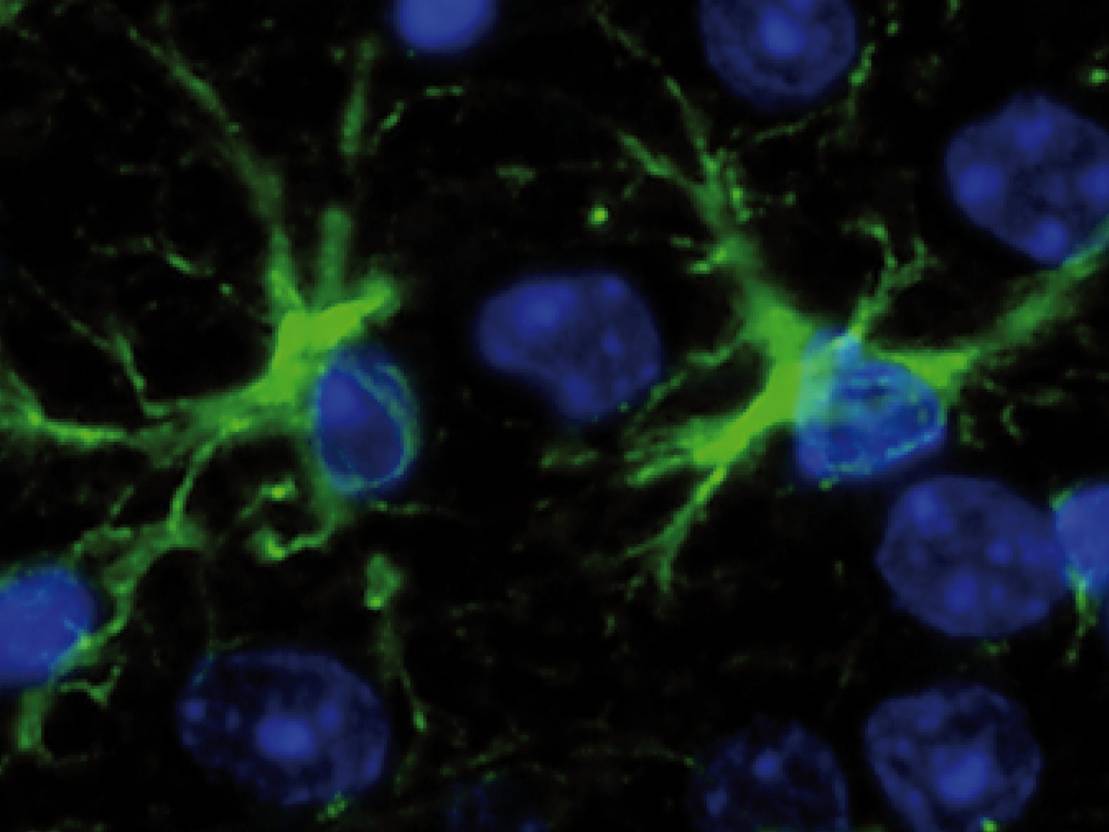 Astrozyten MHH Astrozyten MHH Initiative Wissenschaft Portale