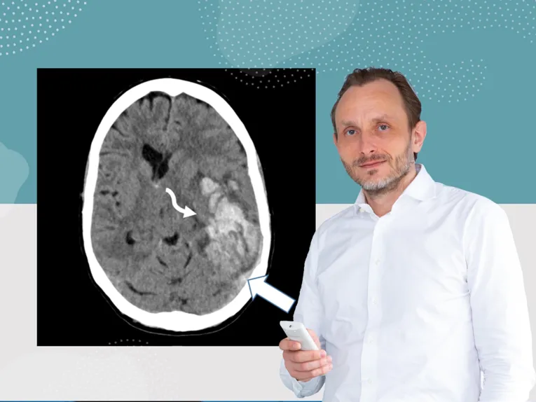 Ein Mann vor dem Bild einer Computertomographie.
