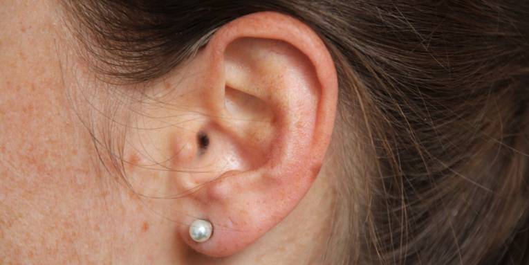 Das Ohr einer dunkelhaarigen Frau mit einem Perlenohrstecker.