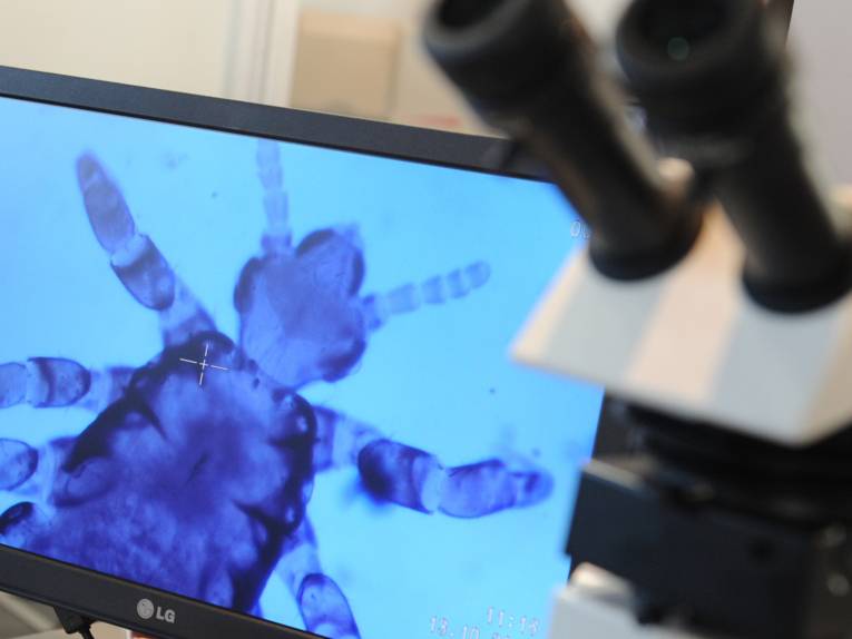 Ein Mikroskop steht neben einem Bildschirm, auf dem ein Tier zu sehen ist.