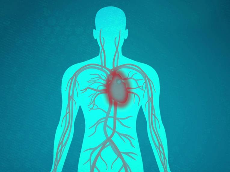 Symbolbild eines menschlichen Oberkörpers mit sichtbarem Herzkreislaufsystem.