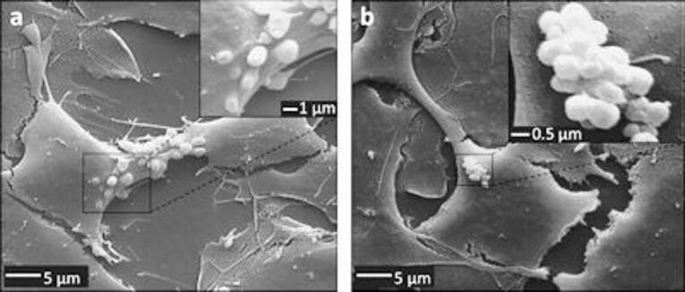 Mit einem Rasterelektronenmikroskop gemachte Aufnahme