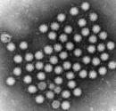 Noroviren unter dem Elektronenmikroskop